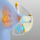 Medela Extractor Magic Inbra Single